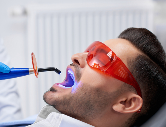 Who Is A Good Candidate For Composite Fillings
